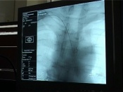 ���������� � ���������� ��������� � ��������� ����� ������ � ������